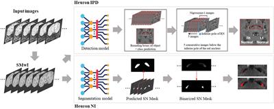 Classification of Parkinson’s disease by deep learning on midbrain MRI